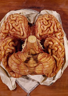 Brain　脳　Born Clones　アメリカ製　模型 Brain脳Born Clonesアメリカ製模型